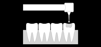 Course Image OPERATORIA DENTAL I 4B 0122